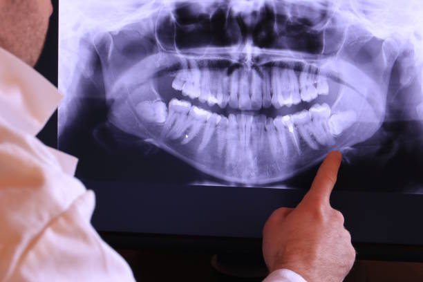 Best Urgent Care for Lost Fillings or Crowns in Whittier, CA
