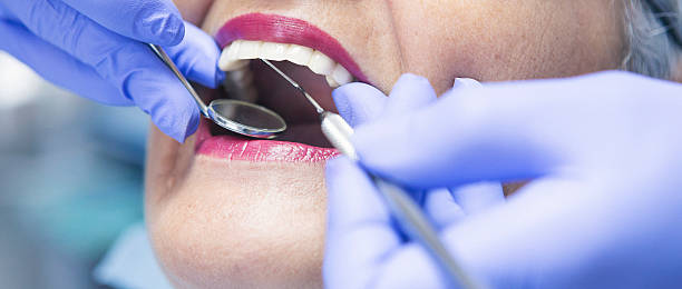 Best Emergency Denture Repair in Whittier, CA